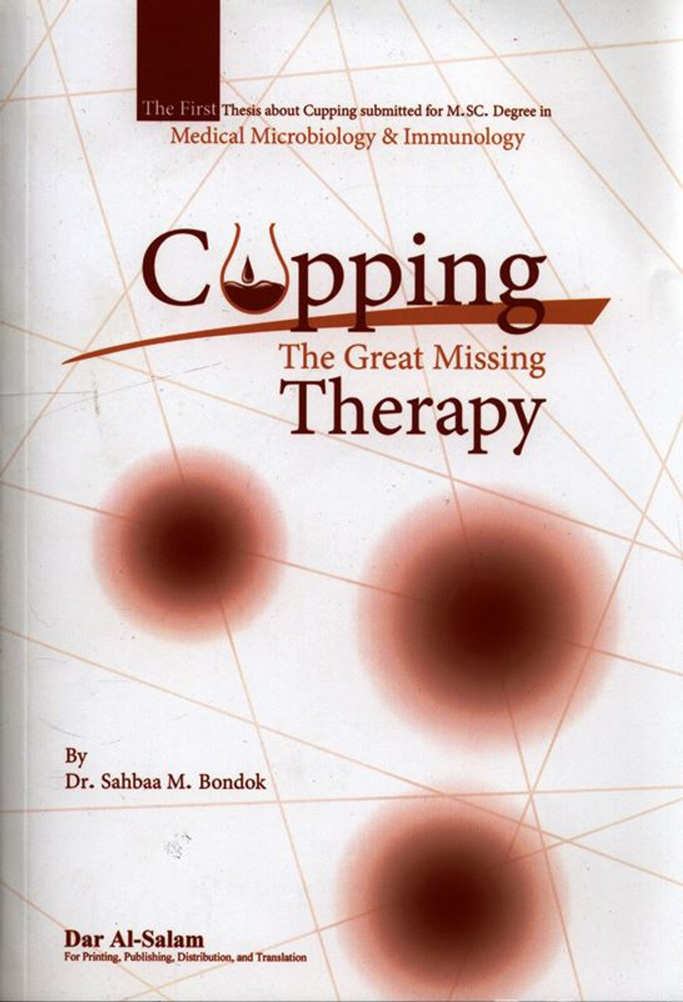 Cupping: Exploring _The Great Missing Therapy_Prophetic Healing