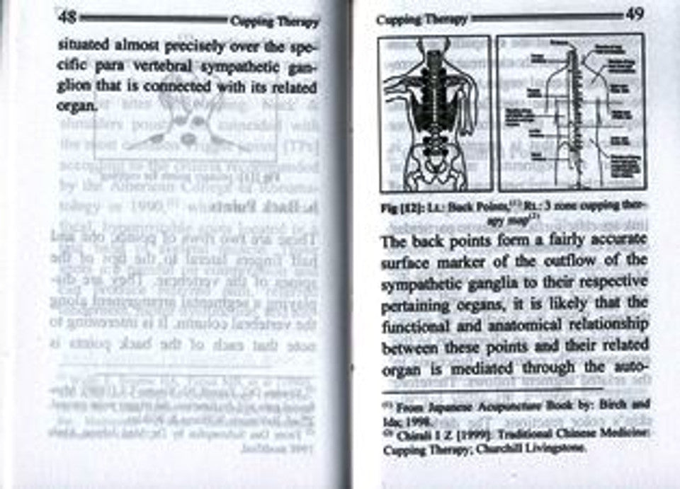 Cupping Therapy_The Ancient Sunnah of Healing_ Prophetic Medicine (Pocket Size)
