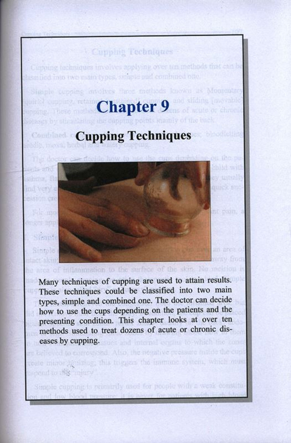 Cupping: Exploring _The Great Missing Therapy_Prophetic Healing