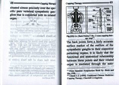 Cupping Therapy_The Ancient Sunnah of Healing_ Prophetic Medicine (Pocket Size)