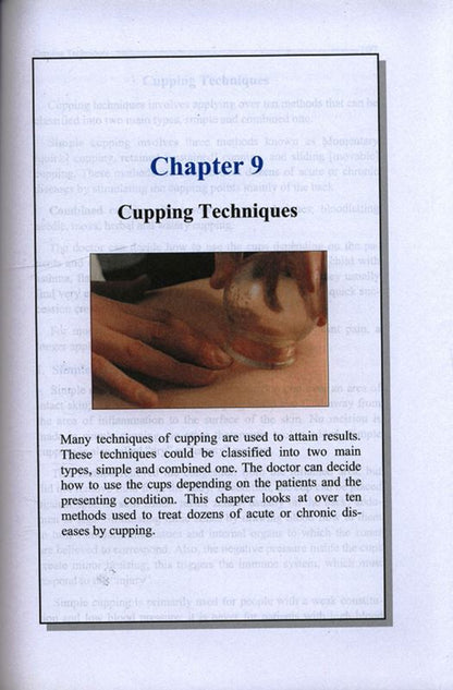 Cupping: Exploring _The Great Missing Therapy_Prophetic Healing